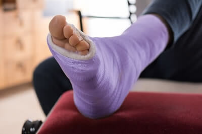 Foot Fractures treatment in the Gastonia, NC 28054; Salisbury, NC 28144; Charlotte, NC 28215; areas