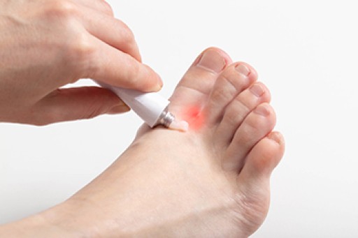 Common Causes of Athlete’s Foot