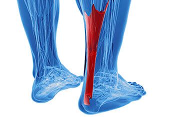 Achilles tendonitis treatment in the Salisbury, NC 28144; Charlotte, NC 28215; Concord, NC 28025 areas